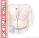 Monitoreo Holter